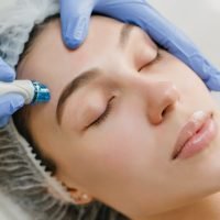 closeup-portrait-beautiful-woman-during-cosmetology-therapy-beauty-salon-professional-dermatology-procedures-lifting-rejuvenation-redevices-healthcare-scaled